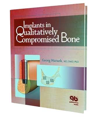 Resim Implants in Qualitatively Compromised Bone
